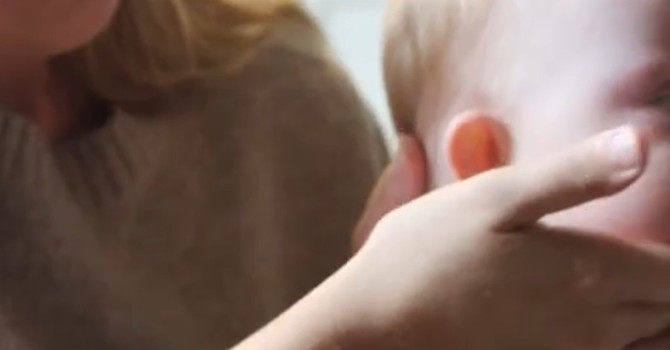 Myofunctional Support